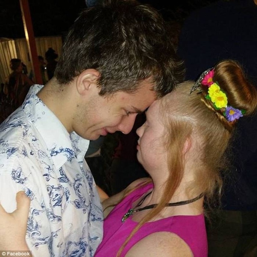 Romantic photos of Down syndrome model Madeleine Stewart and her boyfriend