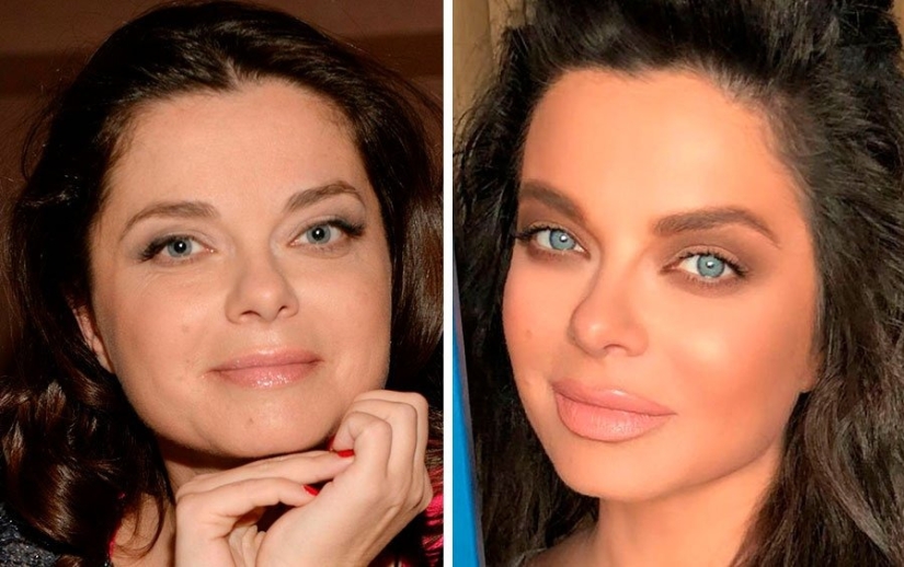 Sad experiments with breasts, alcoholism, early marriage: 9 stars with "skeletons in the closet"