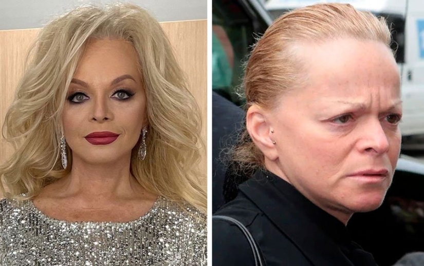 Se lanzaron: 10 estrellas cuya apariencia ahora está lejos de ser ideal