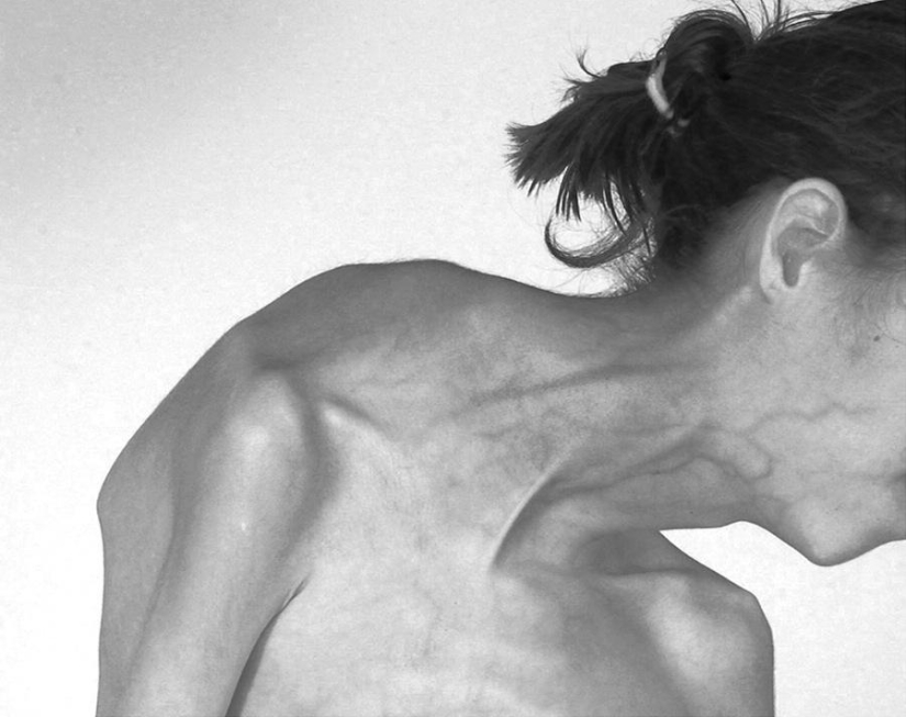 Shocking human mutations