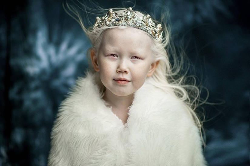 Snow White from Siberia: 8-year-old model with the rarest appearance shocked the Internet Snow White from Siberia: 8-year-old model with the rarest appearance shocked the Internet