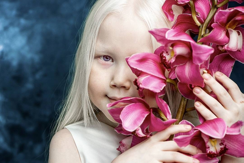 Snow White from Siberia: 8-year-old model with the rarest appearance shocked the Internet Snow White from Siberia: 8-year-old model with the rarest appearance shocked the Internet