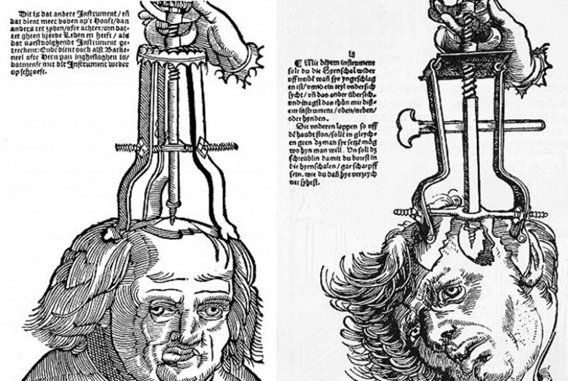 Strange medical procedures that were considered healing in the past Strange medical procedures that were considered healing in the past