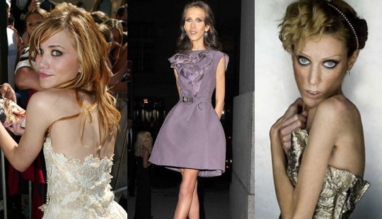 Tenían miedo de engordar: 9 estrellas arruinadas por la anorexia
