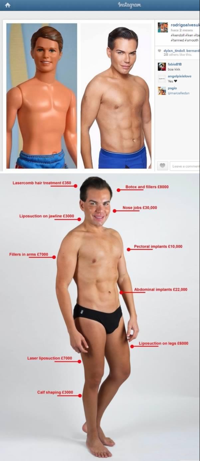 The 7 Most Reckless People With Plastic Surgery Mania