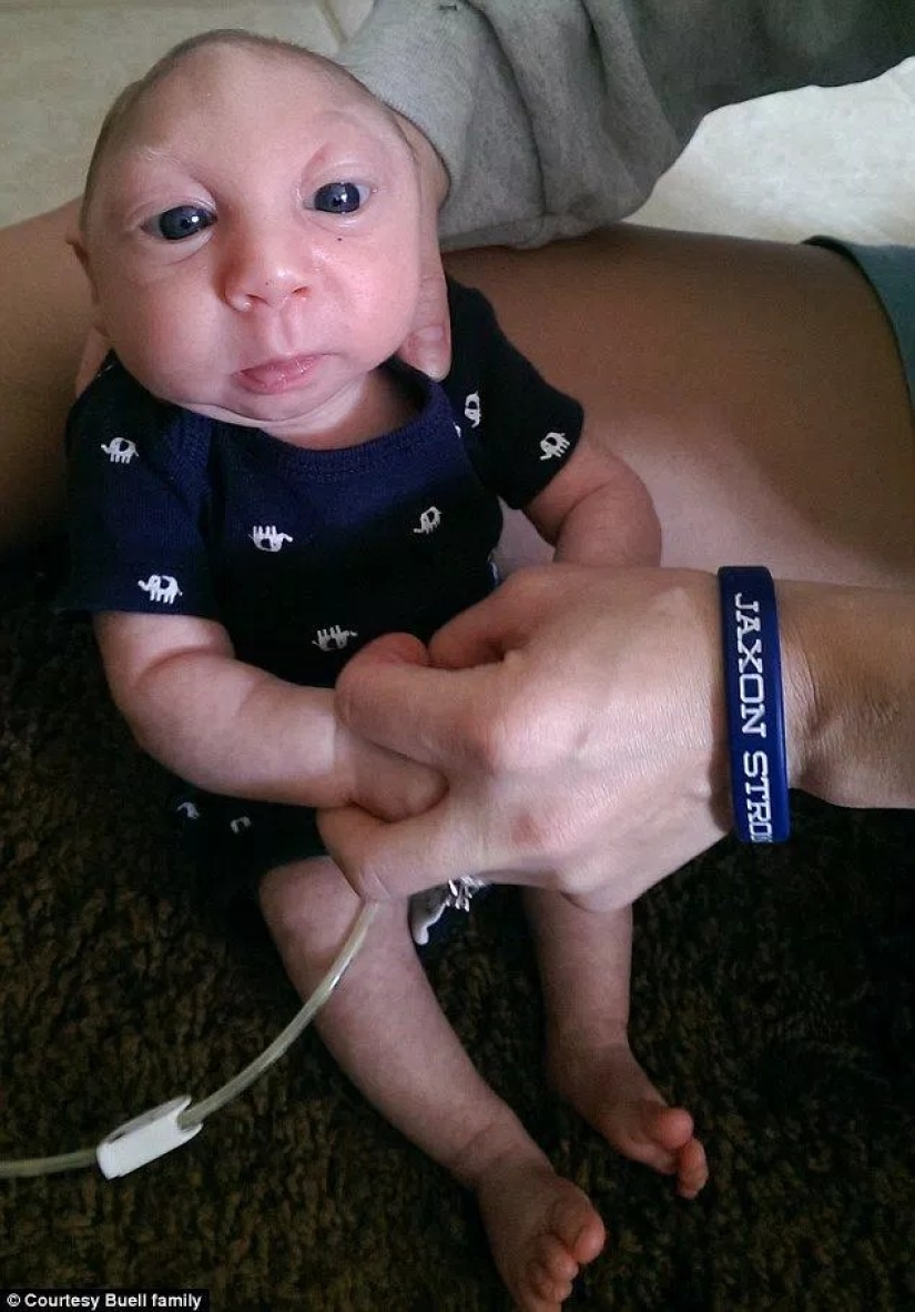 The Amazing Story of Baby Jackson, the Boy Who Lived The Amazing Story of Baby Jackson, the Boy Who Lived