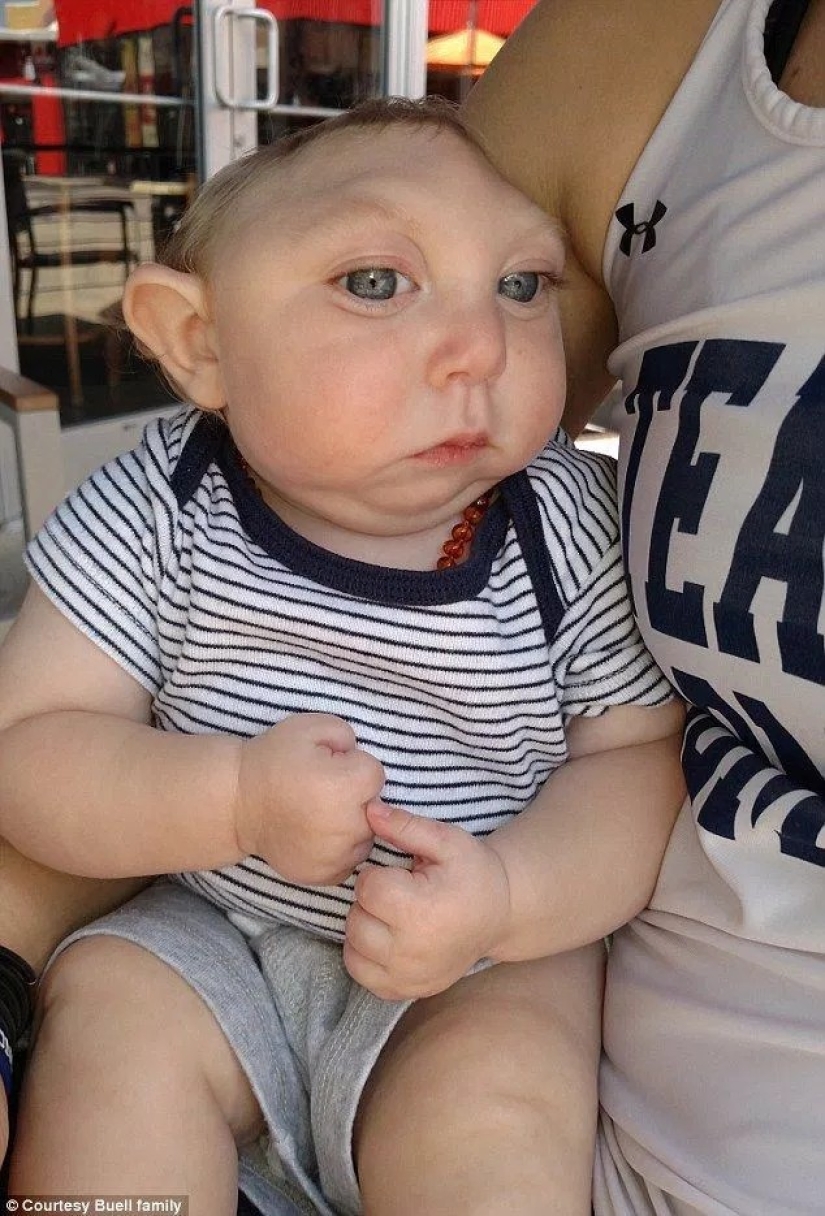 The Amazing Story of Baby Jackson, the Boy Who Lived The Amazing Story of Baby Jackson, the Boy Who Lived