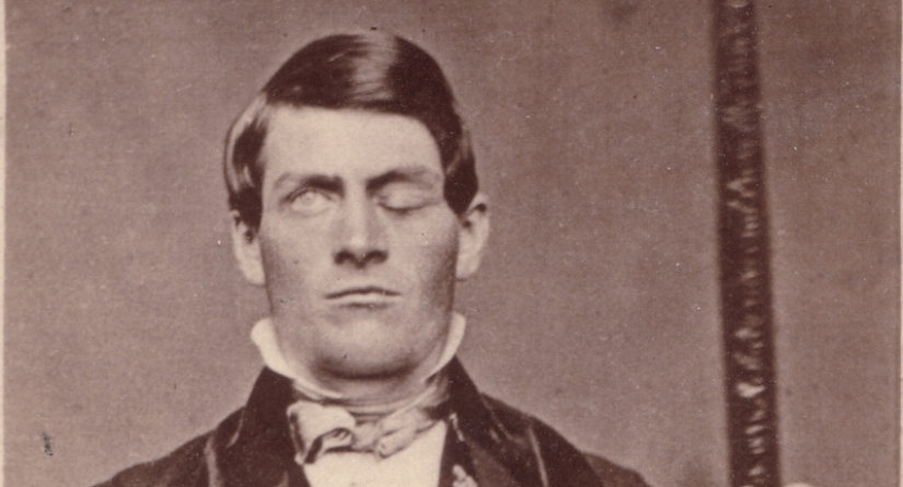 The amazing story of saving a duckling... in a beard