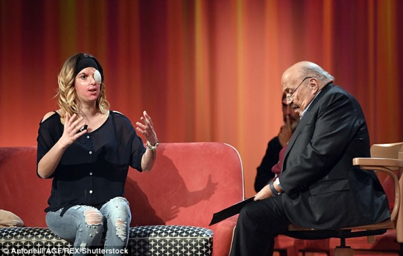 The beauty queen, who was doused with acid by her ex-fiance, showed a disfigured face The beauty queen, who was doused with acid by her ex-fiance, showed a disfigured face