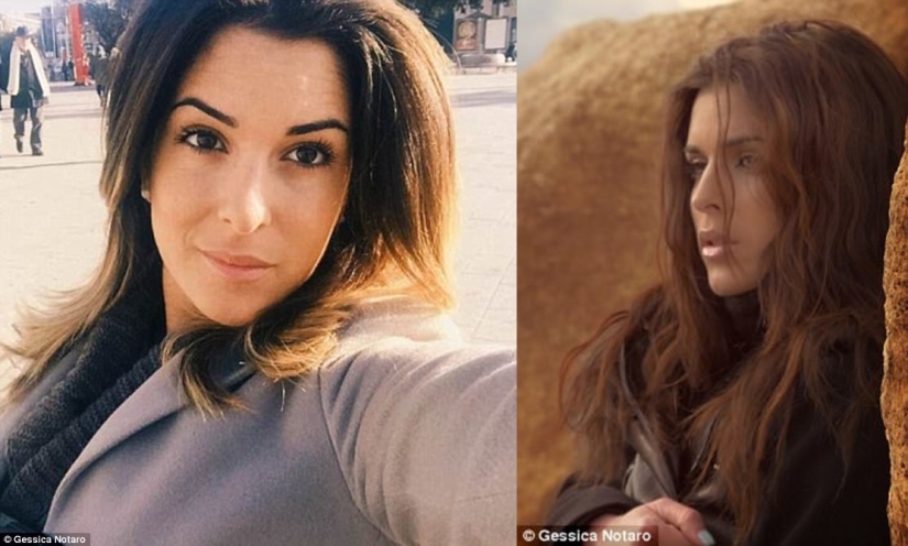 The beauty queen, who was doused with acid by her ex-fiance, showed a disfigured face The beauty queen, who was doused with acid by her ex-fiance, showed a disfigured face