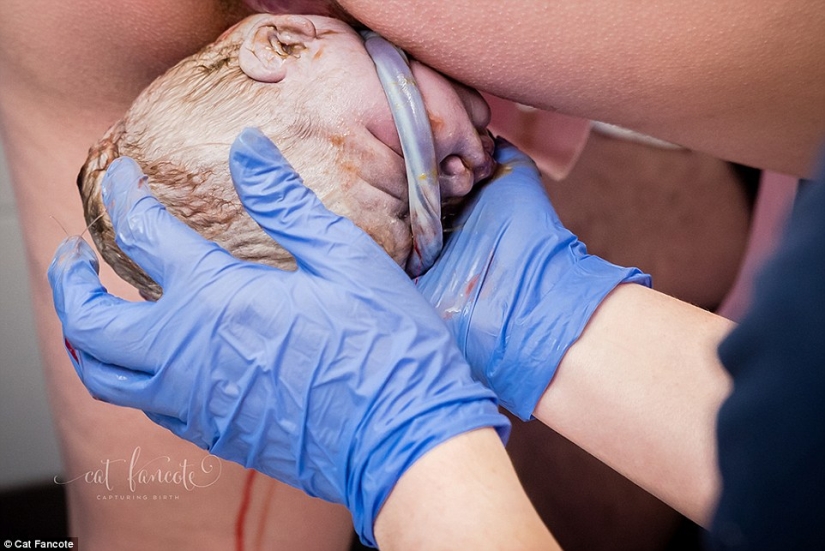 The best works of the winners of the contest of photographers taking pictures of childbirth The best works of the winners of the contest of photographers taking pictures of childbirth