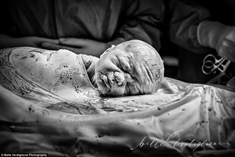 The best works of the winners of the contest of photographers taking pictures of childbirth The best works of the winners of the contest of photographers taking pictures of childbirth