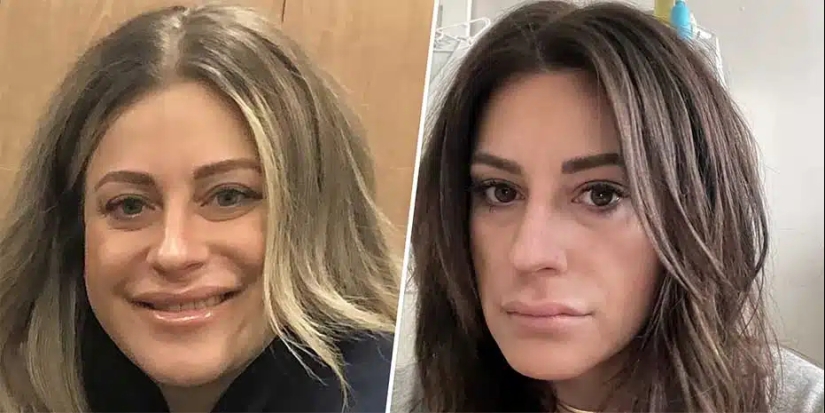 The drug "Ozempik": is it harmful to lose weight quickly with "magic" injections