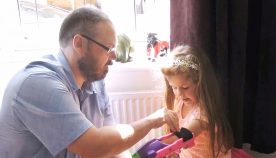 The girl received a 3D prosthesis from a designer who also has no arm
