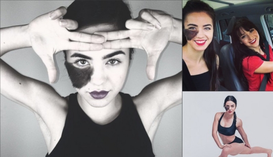 The girl refuses to remove the birthmark, considering it her highlight The girl refuses to remove the birthmark, considering it her highlight