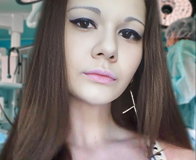 The girl with the biggest lips in the world decided to enlarge her cheekbones