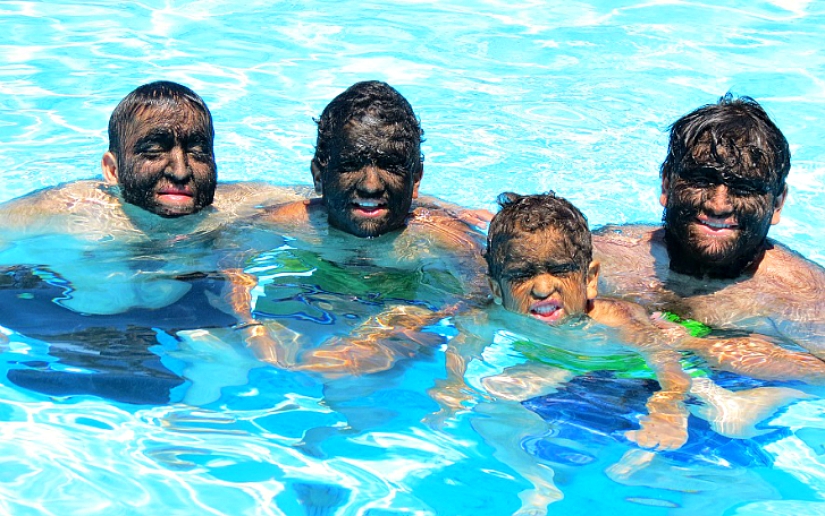 The hairiest family in the world