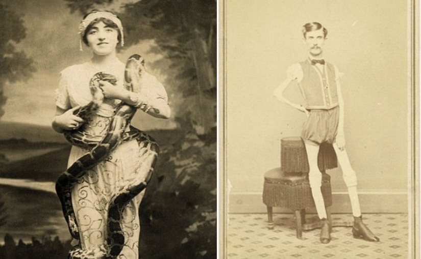 The harsh XIX century: a collection of archival photographs of people with deformities