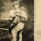 The harsh XIX century: a collection of archival photographs of people with deformities