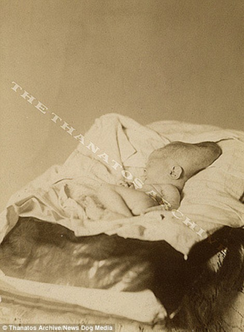 The harsh XIX century: a collection of archival photographs of people with deformities The harsh XIX century: a collection of archival photographs of people with deformities