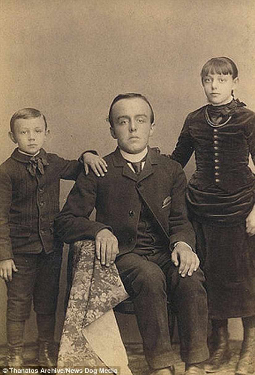 The harsh XIX century: a collection of archival photographs of people with deformities The harsh XIX century: a collection of archival photographs of people with deformities