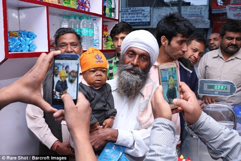 The inexplicable story of a 21-year-old Indian who got stuck in the body of a baby The inexplicable story of a 21-year-old Indian who got stuck in the body of a baby