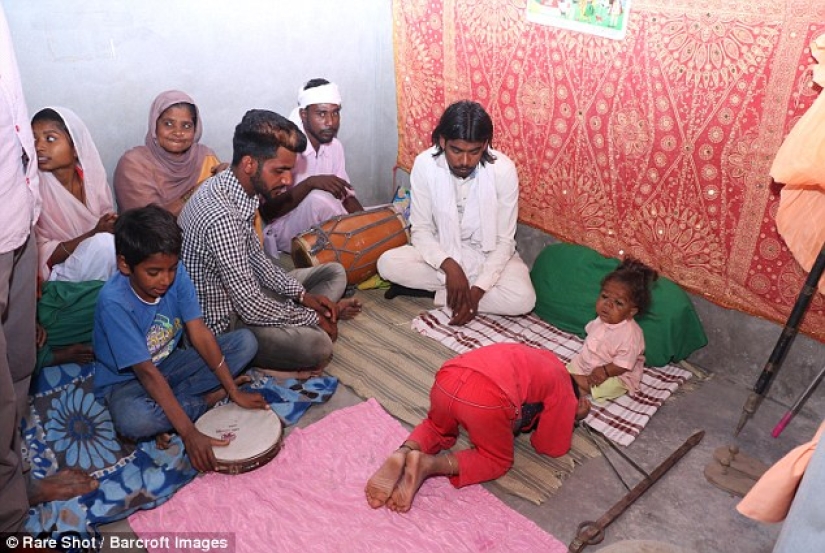 The inexplicable story of a 21-year-old Indian who got stuck in the body of a baby The inexplicable story of a 21-year-old Indian who got stuck in the body of a baby