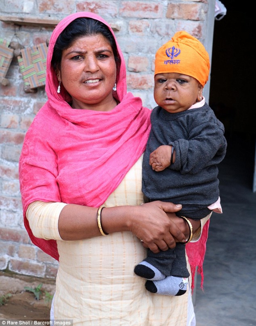 The inexplicable story of a 21-year-old Indian who got stuck in the body of a baby The inexplicable story of a 21-year-old Indian who got stuck in the body of a baby