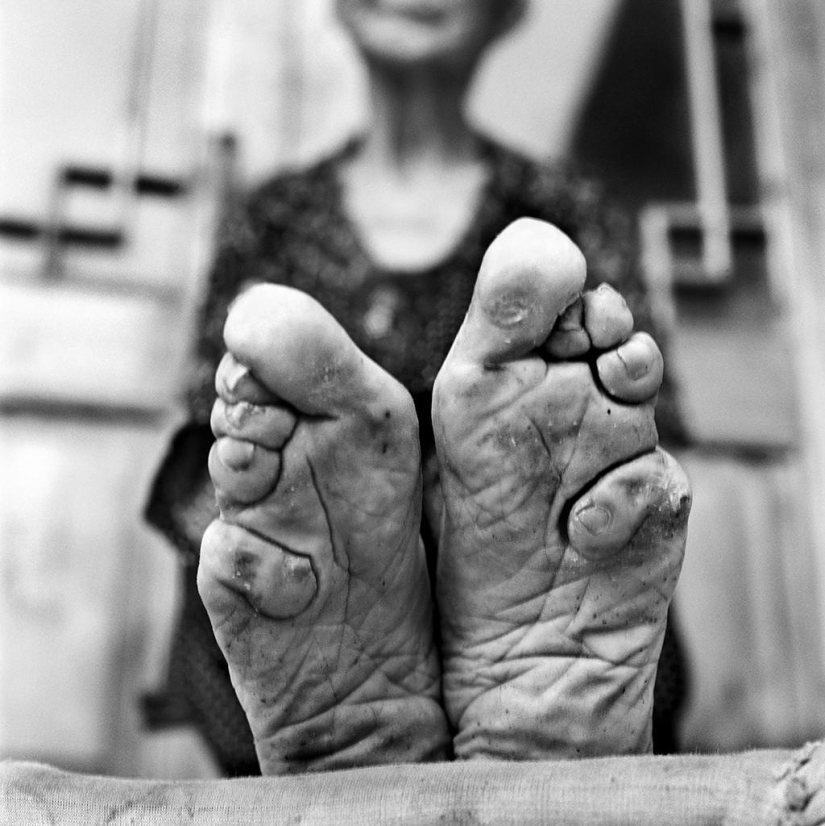 The last living Chinese women with lotus feet