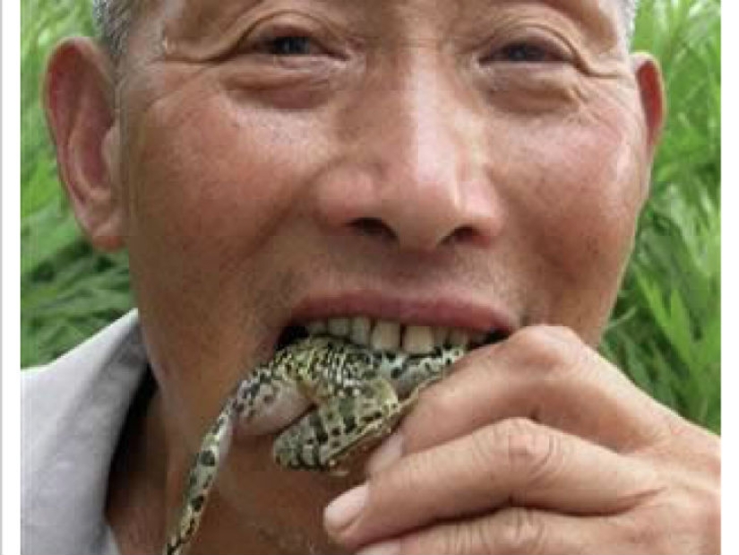 The most creepy objects that have ever been found in a human stomach