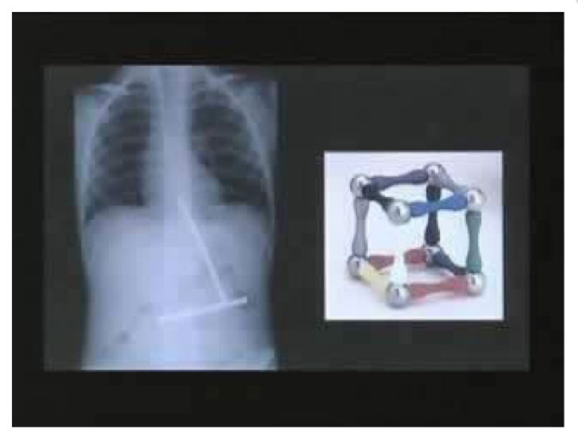 The most creepy objects that have ever been found in a human stomach