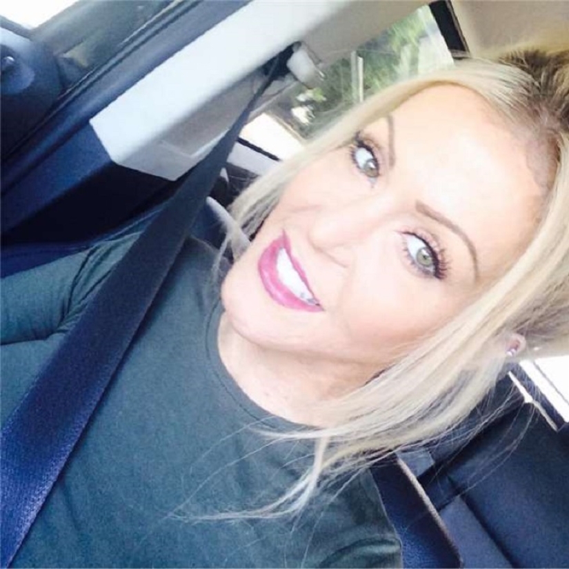 The once almost burned alive Australian woman finally took off her mask