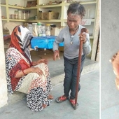 The snake girl sheds her skin every six weeks