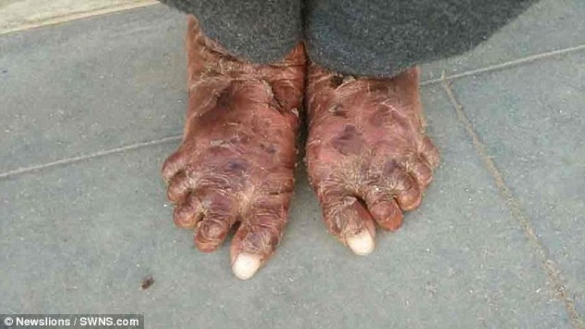 The snake girl sheds her skin every six weeks The snake girl sheds her skin every six weeks