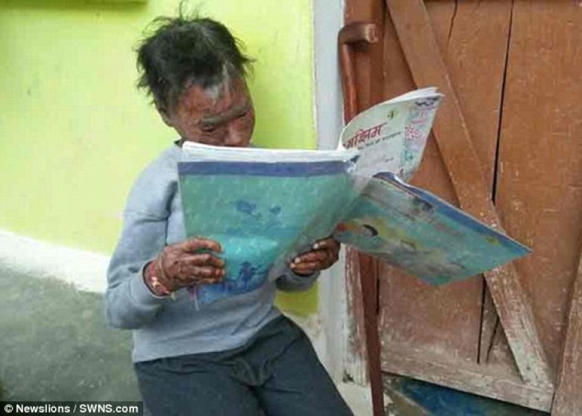 The snake girl sheds her skin every six weeks The snake girl sheds her skin every six weeks