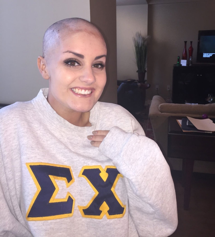 The teenager shaved his head in solidarity with his girlfriend with cancer