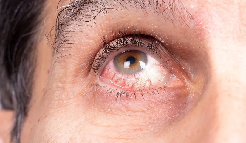 The World's Population By Eye Color