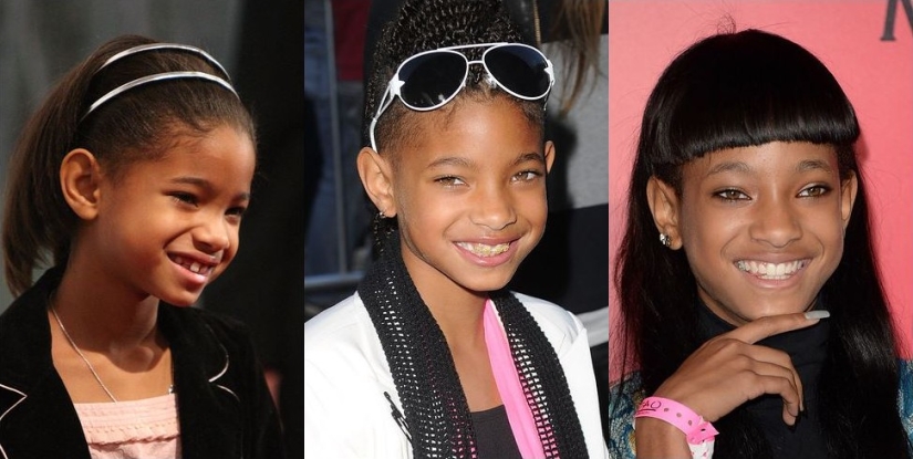 These celebrities will show you how braces can dramatically change your smile These celebrities will show you how braces can dramatically change your smile