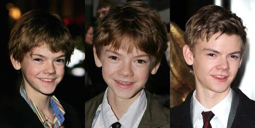 These celebrities will show you how braces can dramatically change your smile These celebrities will show you how braces can dramatically change your smile