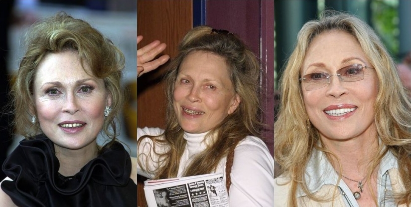 These celebrities will show you how braces can dramatically change your smile These celebrities will show you how braces can dramatically change your smile