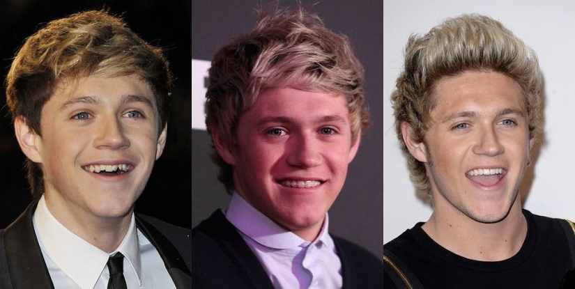 These celebrities will show you how braces can dramatically change your smile These celebrities will show you how braces can dramatically change your smile