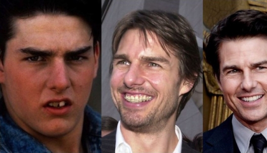 These celebrities will show you how braces can dramatically change your smile These celebrities will show you how braces can dramatically change your smile