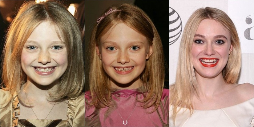 These celebrities will show you how braces can dramatically change your smile These celebrities will show you how braces can dramatically change your smile