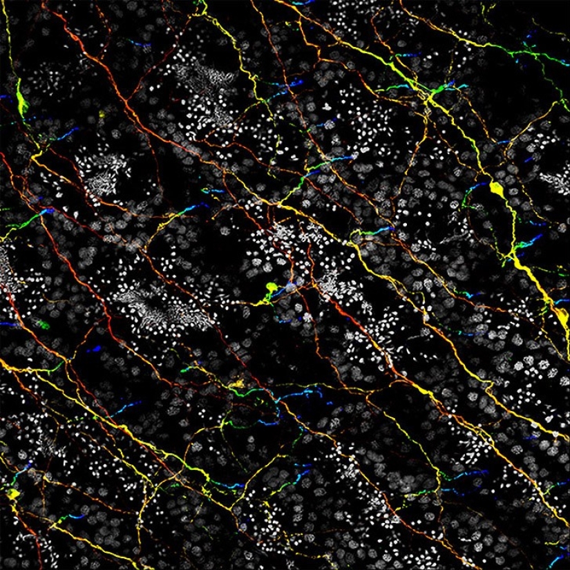 Top 10 Nikon Small World Photos Top 10 Nikon Small World Photos