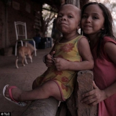 Trapped in a child's body