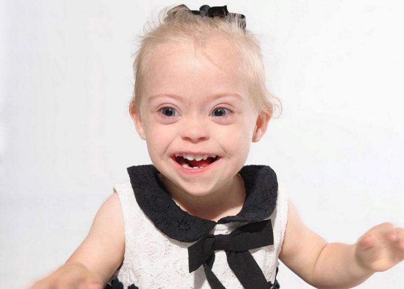 Two-year-old girl with Down syndrome became a model thanks to her radiant smile