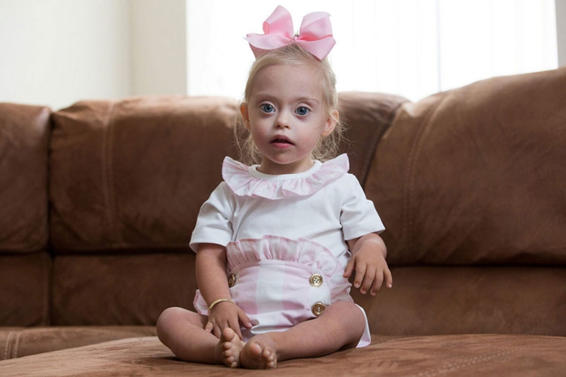 Two-year-old girl with Down syndrome became a model thanks to her radiant smile Two-year-old girl with Down syndrome became a model thanks to her radiant smile