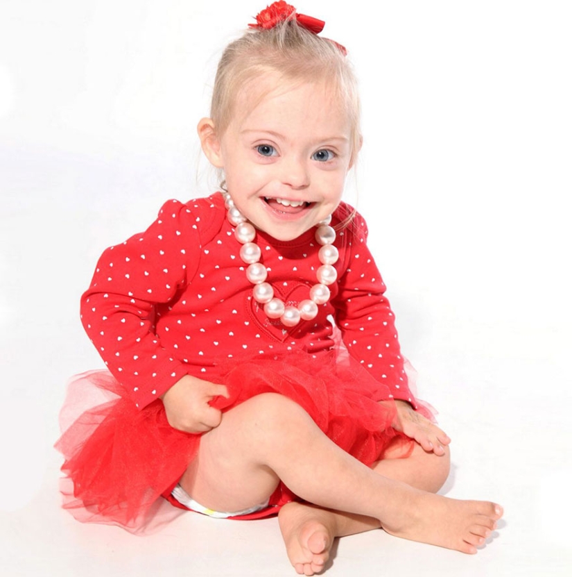 Two-year-old girl with Down syndrome became a model thanks to her radiant smile Two-year-old girl with Down syndrome became a model thanks to her radiant smile