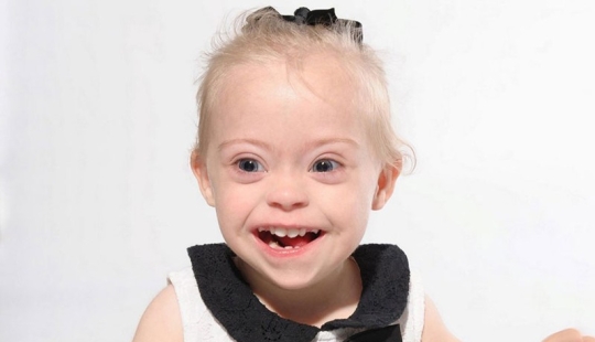 Two-year-old girl with Down syndrome became a model thanks to her radiant smile