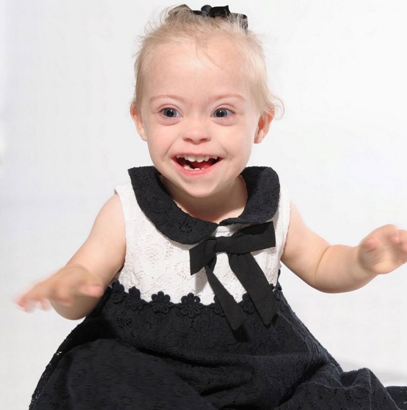 Two-year-old girl with Down syndrome became a model thanks to her radiant smile Two-year-old girl with Down syndrome became a model thanks to her radiant smile